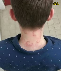 HT15. My 8 year old son been having this for 2 months straight it’s gotten worse from the first time he had this.. What is it