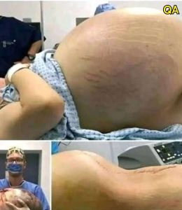 HT4. She went into labor, and you won’t believe what they took out of her wo…See more