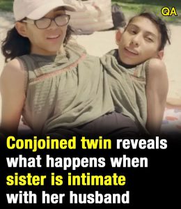 HT19. Conjoined twin reveals what happens when sister is intimate with her husband