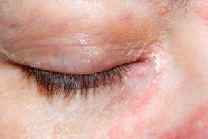 HT4. These are the consequences of sleeping with a… See more