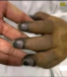 HT4. These are the consequences of painting your nails with…