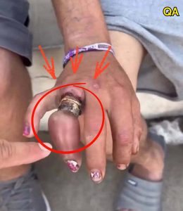 HT4. He promised never to take off his wedding ring… and ended up losi…See more