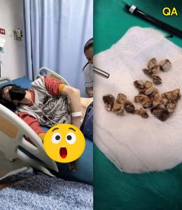 HT4. Man hospitalized after allowing himself to be pe… See more