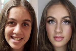 HT17. 40+ Incredible Transformations That Show the Power of Modern Beauty and Skin Care
