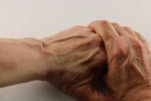 HT4. If your veins are visible in your body, it is a signal of ca… See more