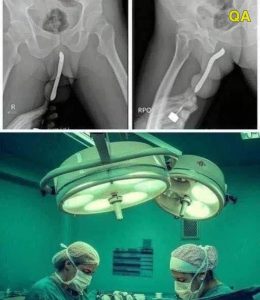 HT4. Young woman was hospitalized after being pene…