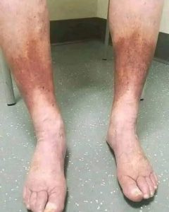 HT4. These are clear signs that he is cr… See more