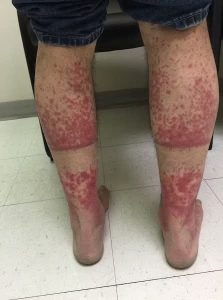 HT17. These are the consequences of sleeping with…See more