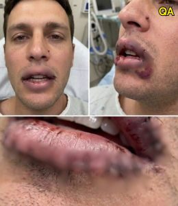 HT4. What happened next caused a man to seek urgent medical attention… see more