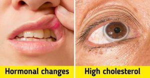 ST4. You should be aware of the warning signs your body is telling you.