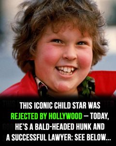 HT10. This iconic child star was rejected by Hollywood but is now a gorgeous, bald-headed hunk and successful lawyer