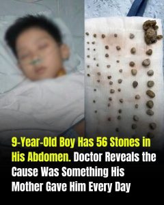 HT9. The Mystery of Childhood Kidney Stones: What Every Parent Should Know