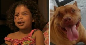 HT5. 5-year-old gets bitten by neighbor’s labrador