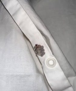 HT7. I found these tiny balls in my bed and nearly had a heart att.ack: here’s what they were