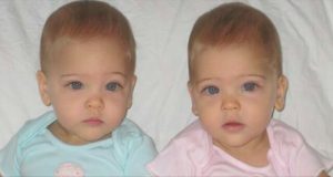 HT10. They called them the world’s most beautiful twins 10 years ago