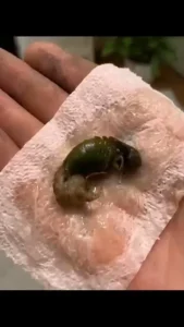 HT7. TERRIFYING DISCOVERY ON BATHROOM FLOOR EXPOSES GRUESOME HIDDEN INVADER IN YOUR HOME
