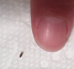 HT9. If you find this bug in your hair, you must read this