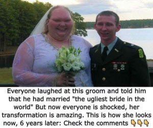 HT10. People called her ‘the ugliest bride in the world’