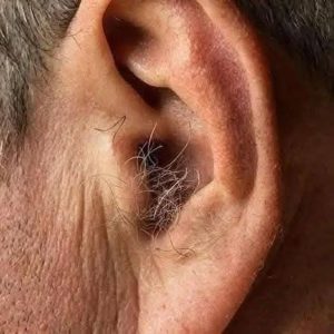 HT5. Did You Know That If Hair Grows On Your Ears It Is Not A Sign Of Illness Or…