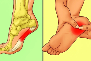 HT9. 7 effective exercises to reduce heel pain and manage plantar fasciitis naturally –