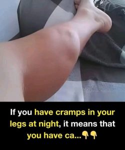 HT9. Who Is Most at Risk of Night Cramps?