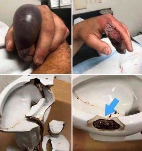 HT9. He went to the bathroom without knowing that there was a…See more