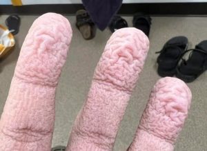 HT5. Wrinkled Fingers After Water Exposure What Your Skin May Be Telling You – Story Of The Day!