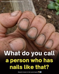 HT10. What Dirty Fingernails Really Reveal