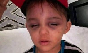 HT9. A 3-year-old boy was found 1 hour ago by his stepfather… See more