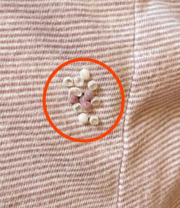 HT10. I found these tiny balls in my bed and nearly had a heart att.ack: here’s what they were