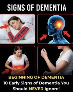 HT9. 10 Early Signs of Dementia You Should Never Ignore