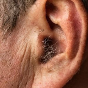 HT9. If you have hair growing on your ears, it’s due to your body