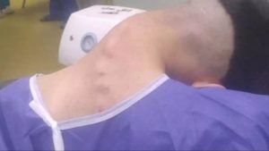 HT5. Young man hospitalized because he dropped his