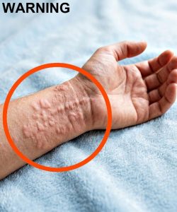 HT9. These are the consequences of sleeping with a… See more