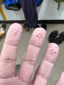 HT5. Why Your Fingers Wrinkle in Water Is Stranger Than It Looks