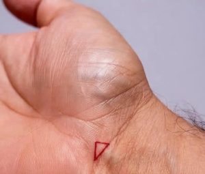 HT9. If You Notice A Triangle Shape On Your Wrist, Here’s What It Could Mean…
