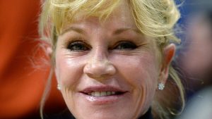 HT5. Melanie Griffith shows off new look after dissolving fillers as cosmetic work went “too far”