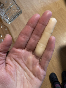 HT5. The Midnight Chill: Why You Might Wake Up with a Pale, Numb Finger (And How to Gently Restore Warmth and Circulation)