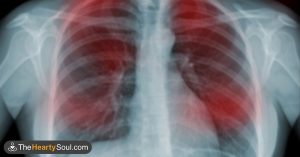 HT5. 20 Early Warning Signs of Cancer and How to Reduce Your Cancer Risk