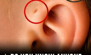 HT5. Discover the Meaning of This Tiny Mark Near the Ear Its More Common Than You Think